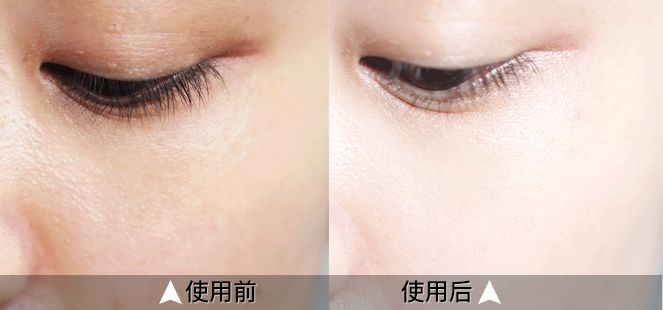 日本腾素效果如何？实测30天揭秘真相与避坑诀窍优质